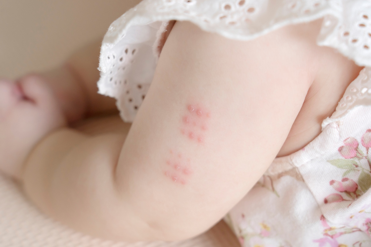 【川崎市の定期予防接種】基本条件と新生児や転入時の手続き方法